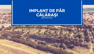 Implant de par Calarasi